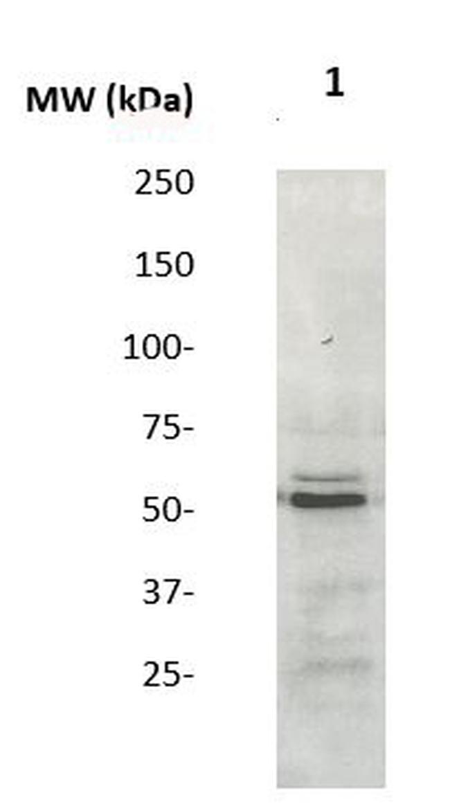 SOCS-4 Antibody in Western Blot (WB)
