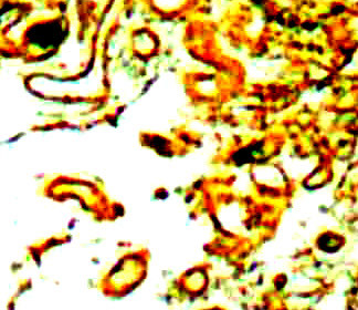 Claudin 10 Antibody in Immunohistochemistry (Paraffin) (IHC (P))