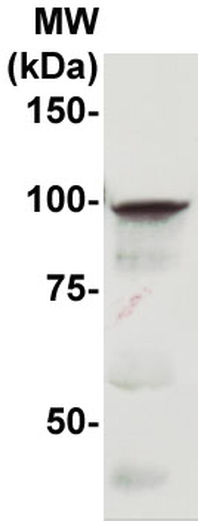 CD10 Antibody in Western Blot (WB)