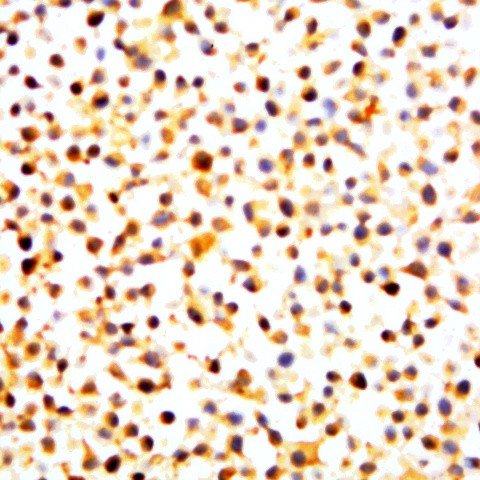 BCL-2 Antibody in Immunocytochemistry (ICC/IF)
