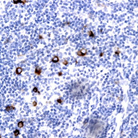 CD14 Antibody in Immunohistochemistry (Paraffin) (IHC (P))