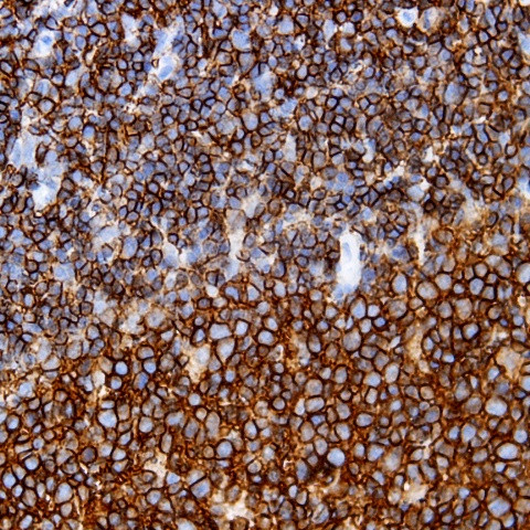 CD45/LCA Antibody in Immunohistochemistry (Paraffin) (IHC (P))