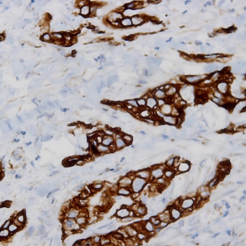 FGFR-2 Antibody in Immunohistochemistry (Paraffin) (IHC (P))