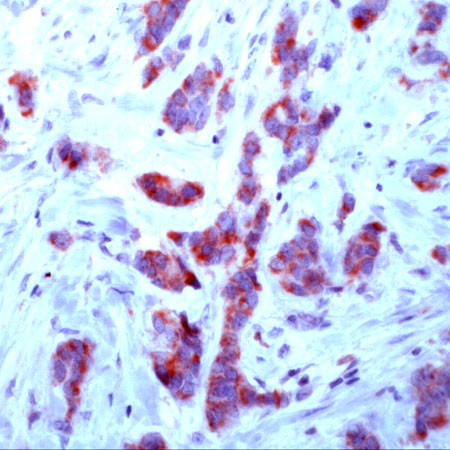 FGFR-1 Antibody in Immunohistochemistry (Paraffin) (IHC (P))
