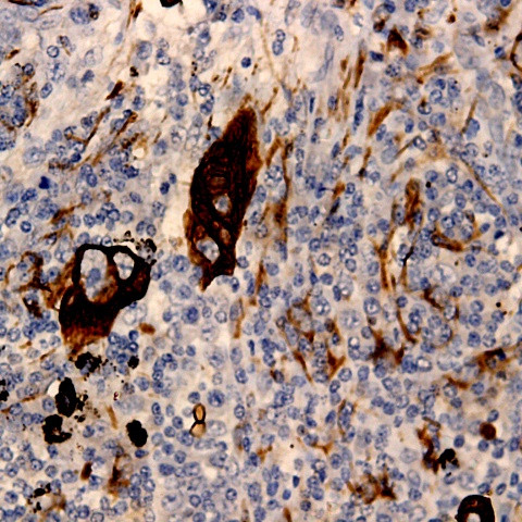 CaM Kinase IV Antibody in Immunohistochemistry (PFA fixed) (IHC (PFA))