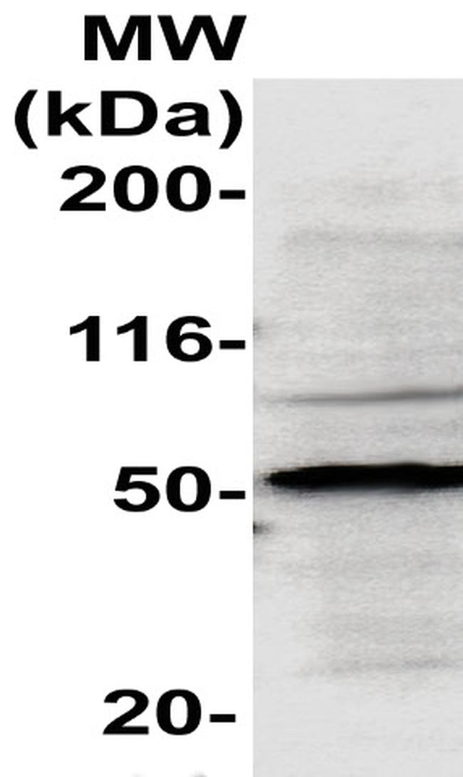 Blk Antibody in Western Blot (WB)