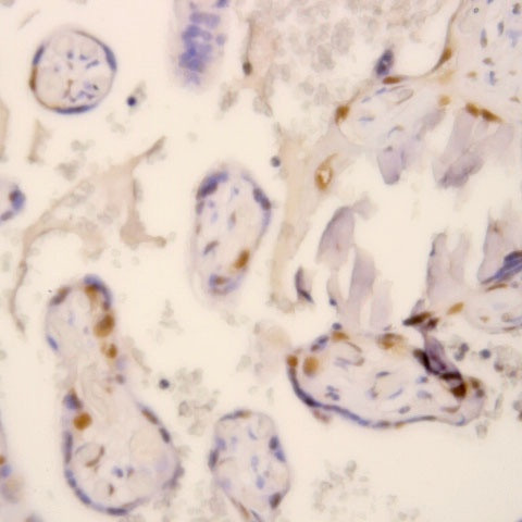 TGF beta Receptor II Antibody in Immunohistochemistry (Paraffin) (IHC (P))