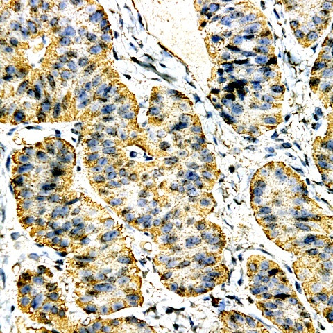 Calcitonin Antibody in Immunohistochemistry (Paraffin) (IHC (P))