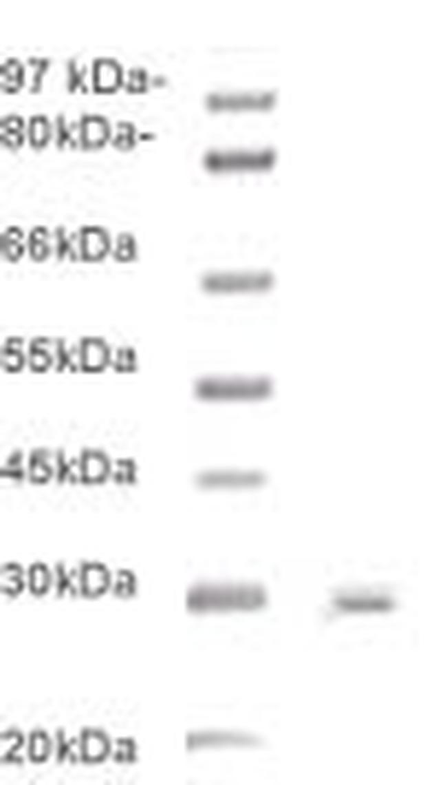 Phospho-BCL-2 (Ser70) Antibody in Western Blot (WB)