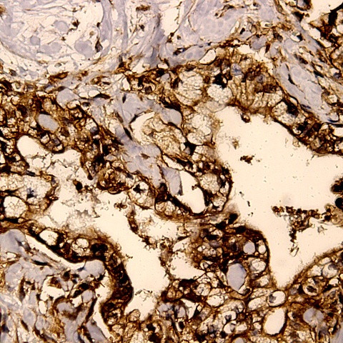 Phospho-BCL-XL (Ser62) Antibody in Immunohistochemistry (Paraffin) (IHC (P))