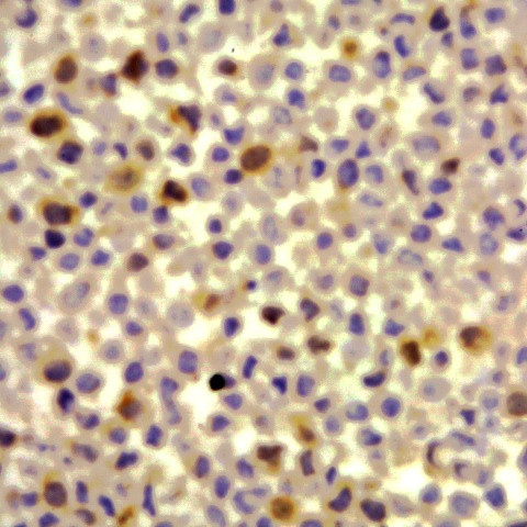 Phospho-ELK1 (Ser389) Antibody in Immunocytochemistry (ICC/IF)