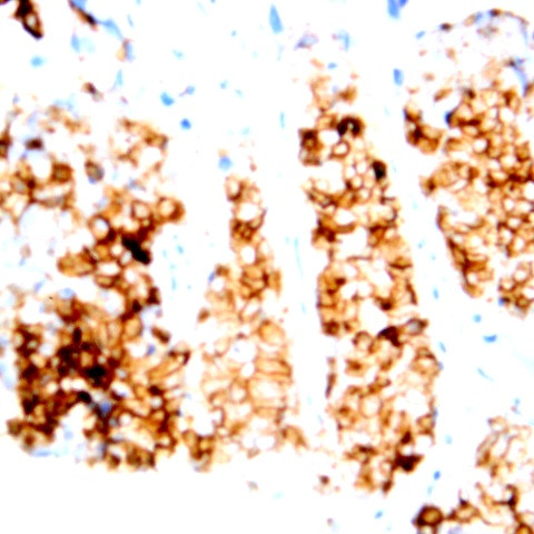 Calretinin Antibody in Immunohistochemistry (Paraffin) (IHC (P))