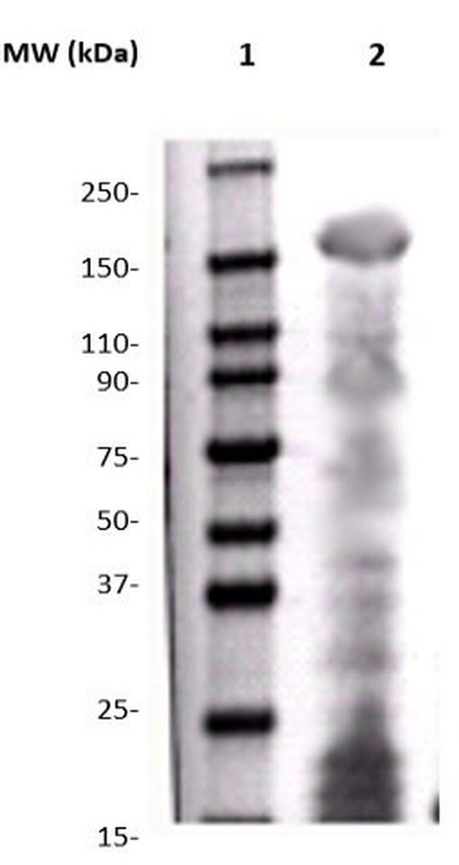 Phospho-c-erbB2 (HER2) (Tyr1221, Tyr1222) Antibody in Western Blot (WB)