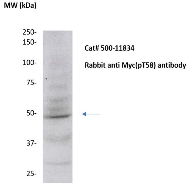 Phospho-Myc (Thr58) Antibody in Western Blot (WB)