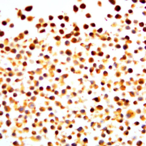 Phospho-NF-kB p100/p52 (Ser866) Antibody in Immunocytochemistry (ICC/IF)