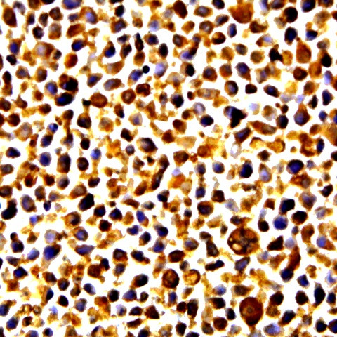 Phospho-NF-kB p65 (Ser276) Antibody in Immunocytochemistry (ICC/IF)