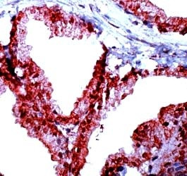 Phospho-NF-kB p65 (Thr254) Antibody in Immunocytochemistry (ICC/IF)