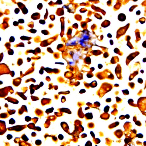 Phospho-Raf-1 (Ser259) Antibody in Immunocytochemistry (ICC/IF)