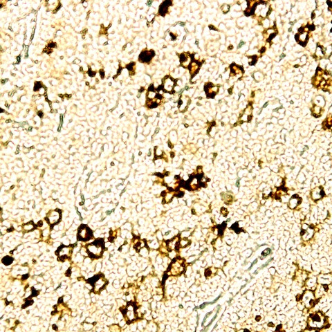 CD15 Antibody in Immunohistochemistry (Paraffin) (IHC (P))