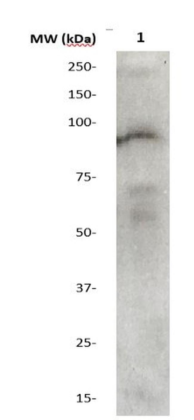 Phospho-STAT4 (Tyr693) Antibody in Western Blot (WB)