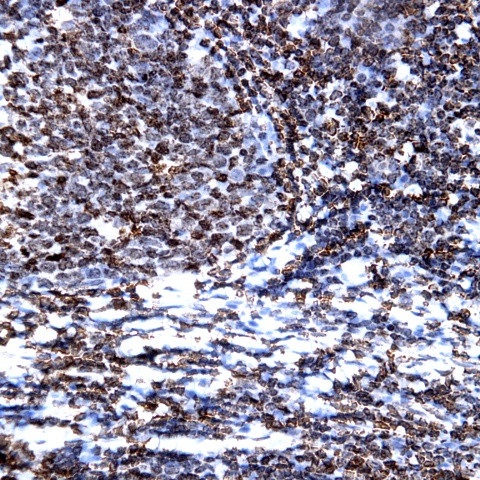 CD1a Antibody in Immunohistochemistry (Paraffin) (IHC (P))
