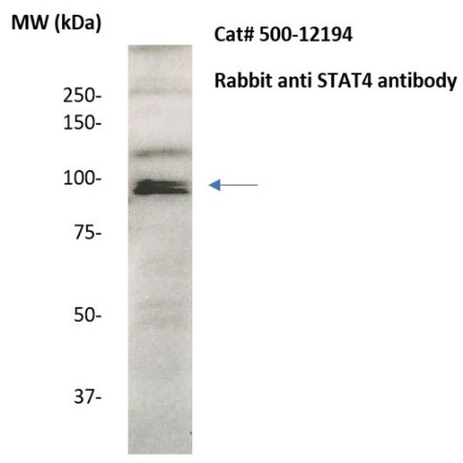 STAT4 Antibody in Western Blot (WB)