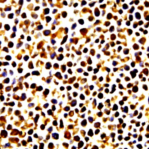 Phospho-ELK-1 (Ser383) Antibody in Immunocytochemistry (ICC/IF)