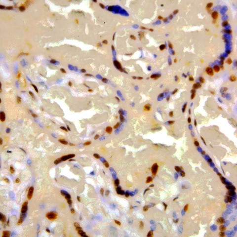 Phospho-IGF-1R (Tyr1161) Antibody in Immunohistochemistry (Paraffin) (IHC (P))