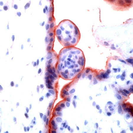 TGF beta R1 Antibody in Immunohistochemistry (Paraffin) (IHC (P))
