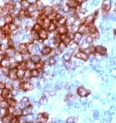 CD3 Antibody in Immunohistochemistry (Paraffin) (IHC (P))