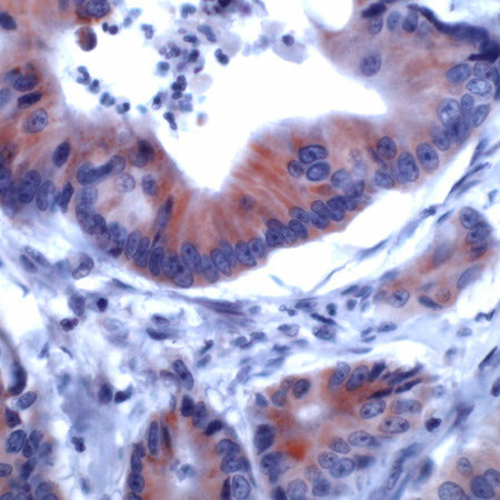 IRS-1 Antibody in Immunohistochemistry (Paraffin) (IHC (P))