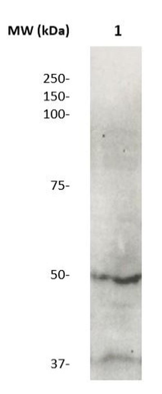 MMP-3 (MMP-10) Antibody in Western Blot (WB)