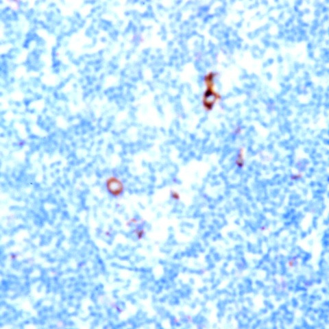 CD31 (PECAM) Antibody in Immunohistochemistry (Paraffin) (IHC (P))