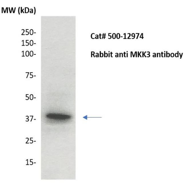 MKK3 Antibody in Western Blot (WB)