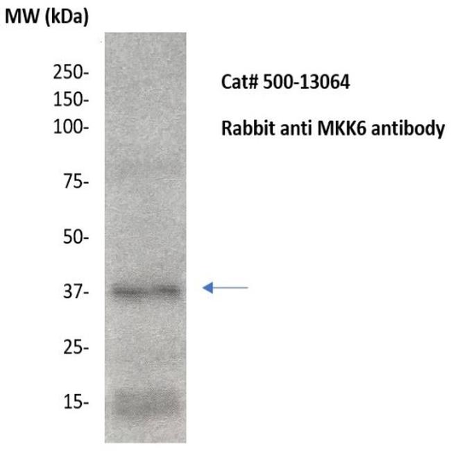 MKK6 Antibody in Western Blot (WB)