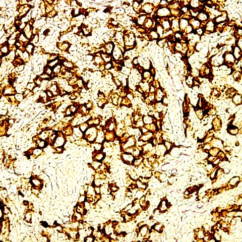 CD30 Antibody in Immunohistochemistry (Paraffin) (IHC (P))