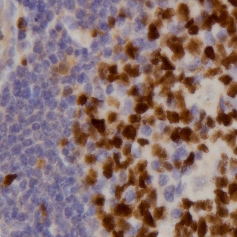 CD25 Antibody in Immunohistochemistry (Paraffin) (IHC (P))