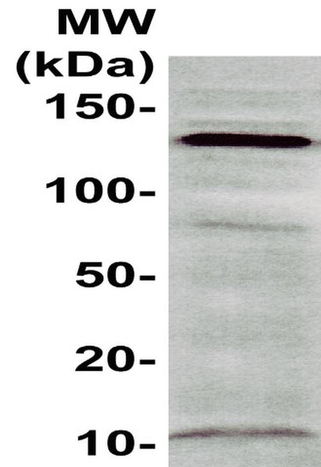 CD29 Antibody in Western Blot (WB)