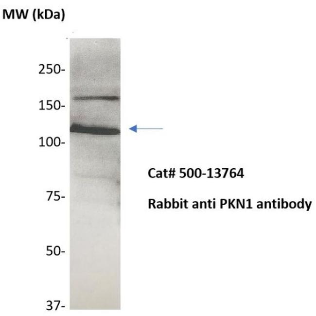 PKN Antibody in Western Blot (WB)