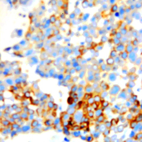 Chromogranin B Antibody in Immunohistochemistry (Paraffin) (IHC (P))