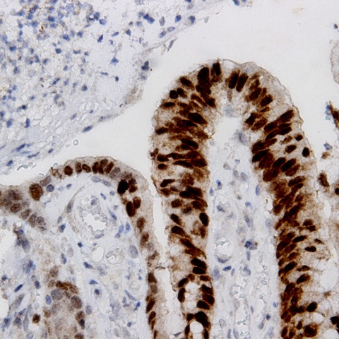 Cyclin D1 Antibody in Immunohistochemistry (Paraffin) (IHC (P))