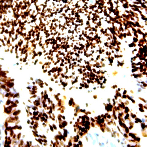 Estrogen Receptor alpha (ER-alpha) Antibody in Immunohistochemistry (Paraffin) (IHC (P))