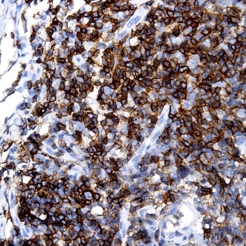 Lambda Light chain Antibody in Immunohistochemistry (Paraffin) (IHC (P))