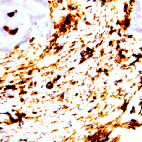 Neurofilaments (200kDa/68kDa) Antibody in Immunohistochemistry (Paraffin) (IHC (P))
