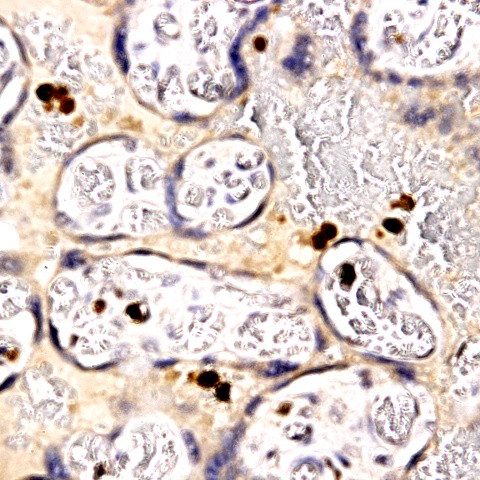 PLAP Antibody in Immunohistochemistry (Paraffin) (IHC (P))