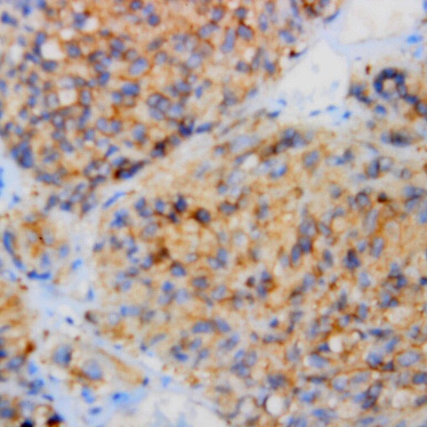 Synaptophysin Antibody in Immunohistochemistry (Paraffin) (IHC (P))