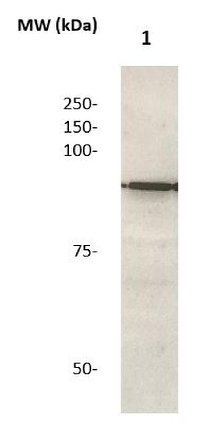 Catenin beta Antibody in Western Blot (WB)