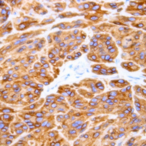 Caspase 8 Antibody in Immunohistochemistry (Paraffin) (IHC (P))
