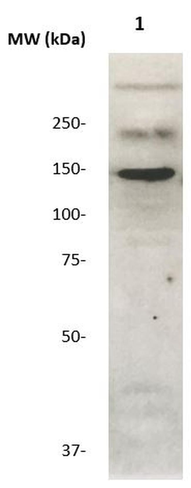 c-erbB-2 Antibody in Western Blot (WB)