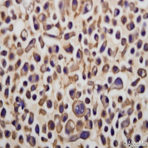 EGFR Antibody in Immunocytochemistry (ICC/IF)